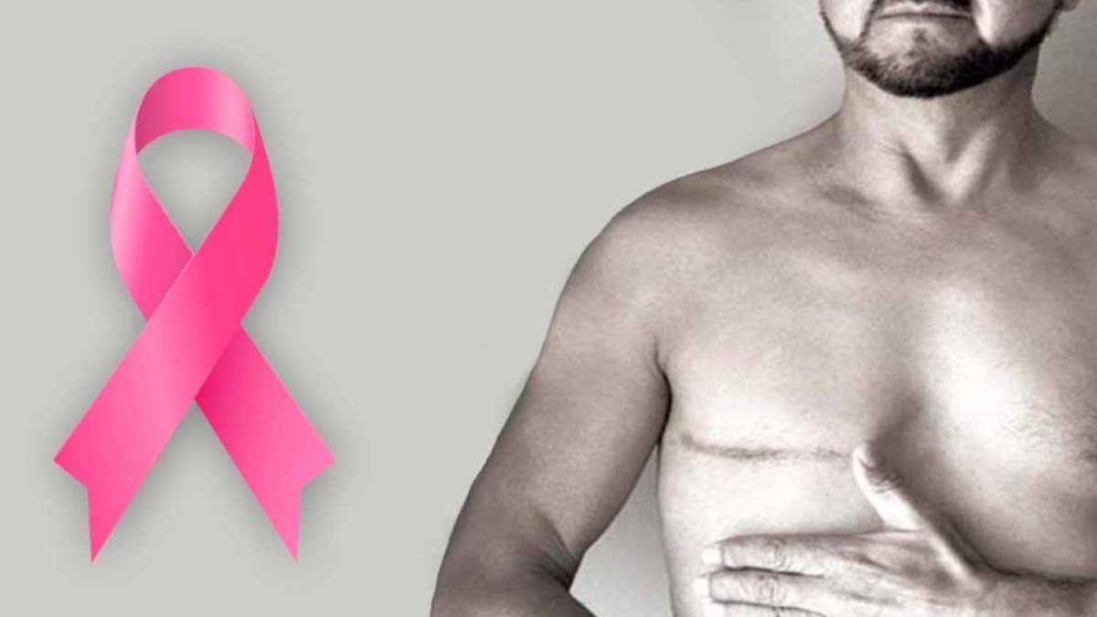 Rompiendo estigmas: Aumentan casos de cáncer de mama en Nayarit; van 5 hombres afectados en 2026